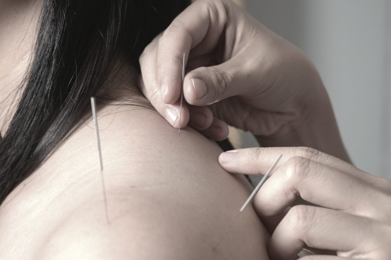 medecine chinoise geneve - Centre de soins - Thérapies naturelles - Acupuncture